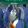 특별기획 아직도 나이 탓? 무릎 속 연골의 비밀