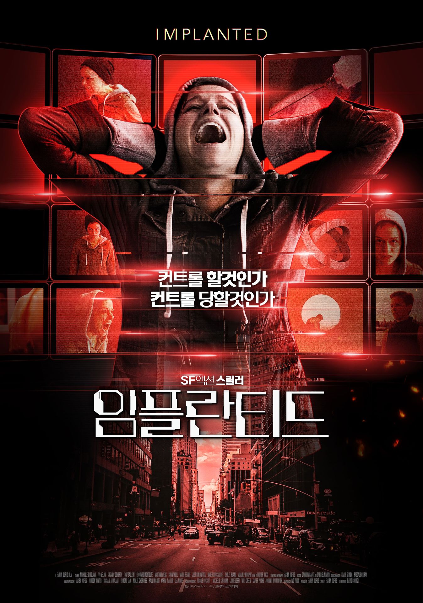 임플란티드