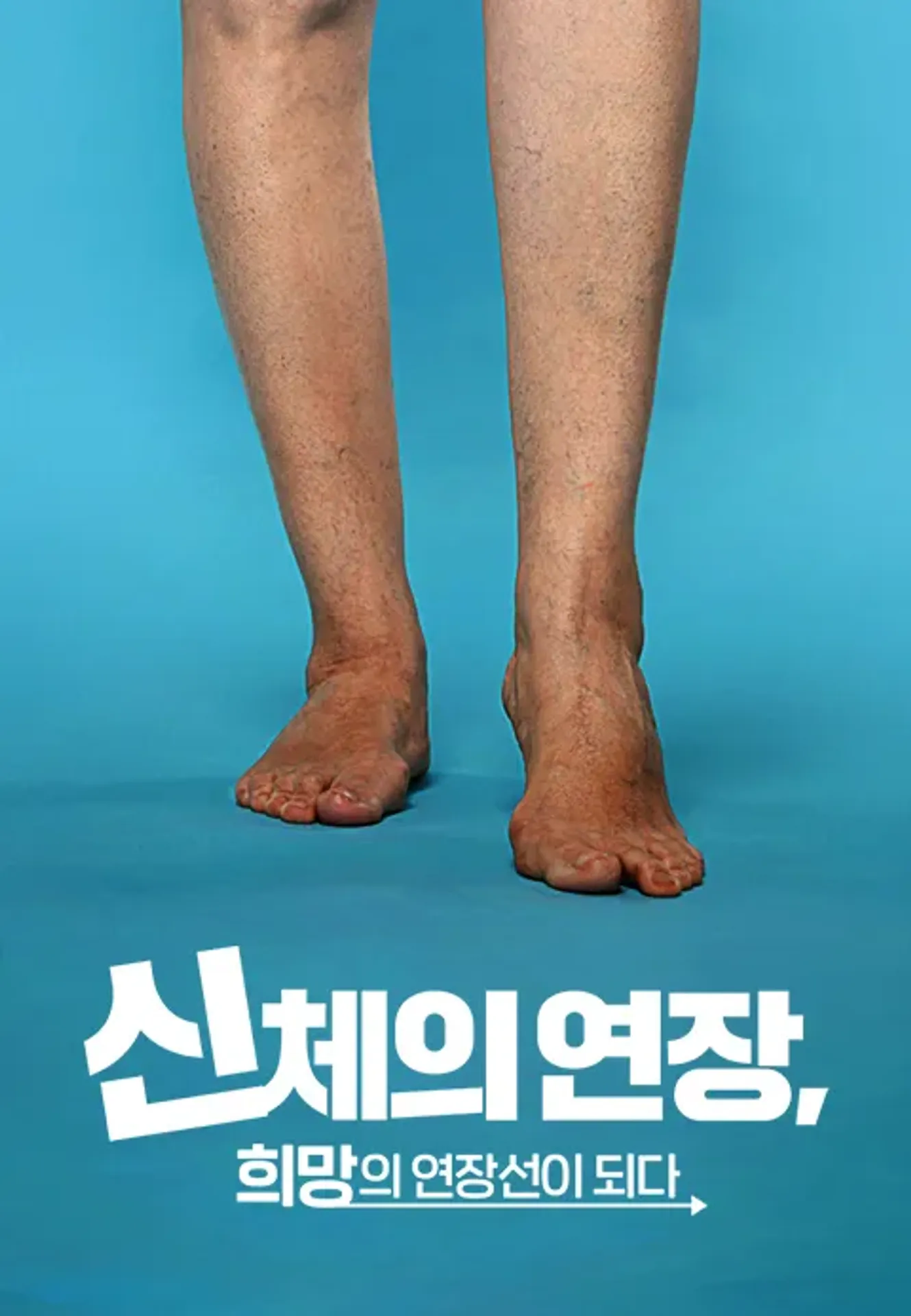 신체의 연장, 희망의 연장선이 되다