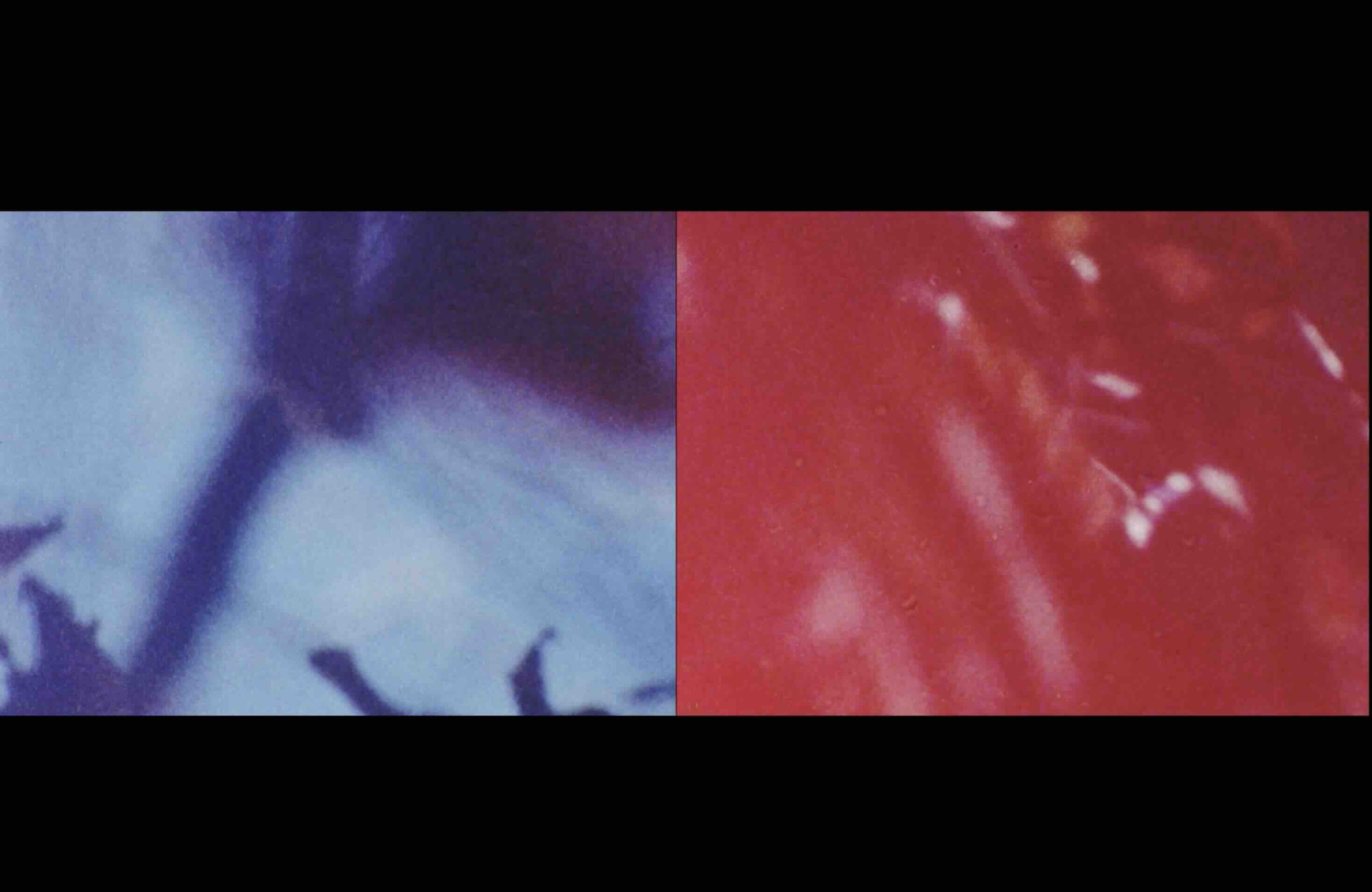 광합 파트1