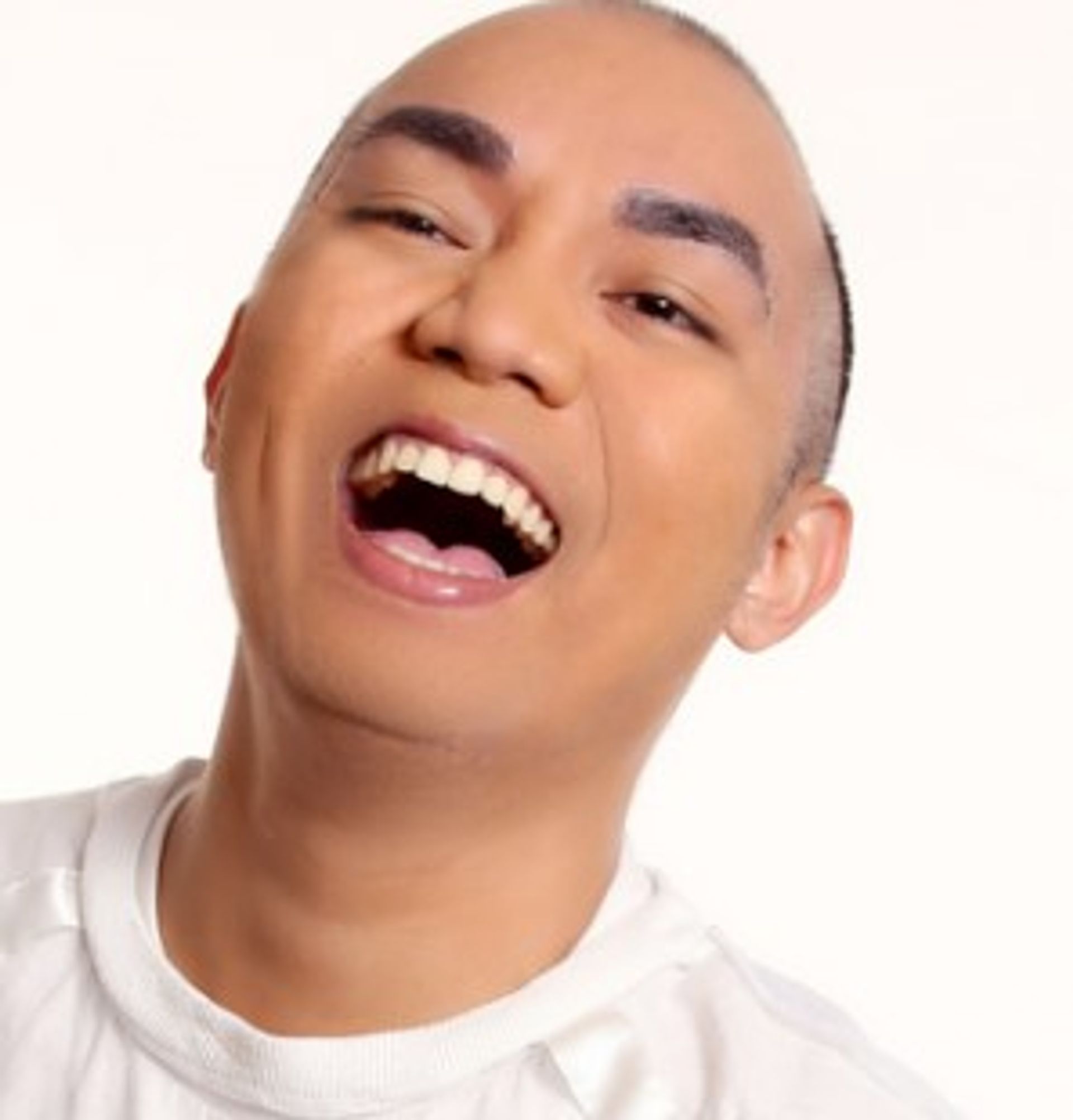 채드 키니스
